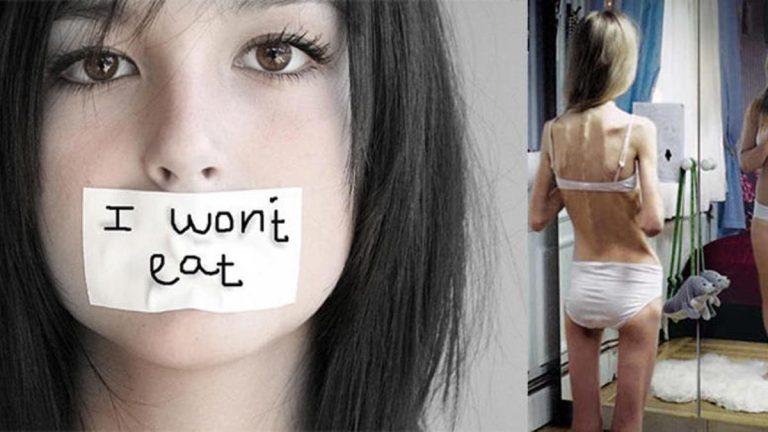 Διατροφικές διαταραχές εφήβων – θεραπεία και αντιμετώπιση