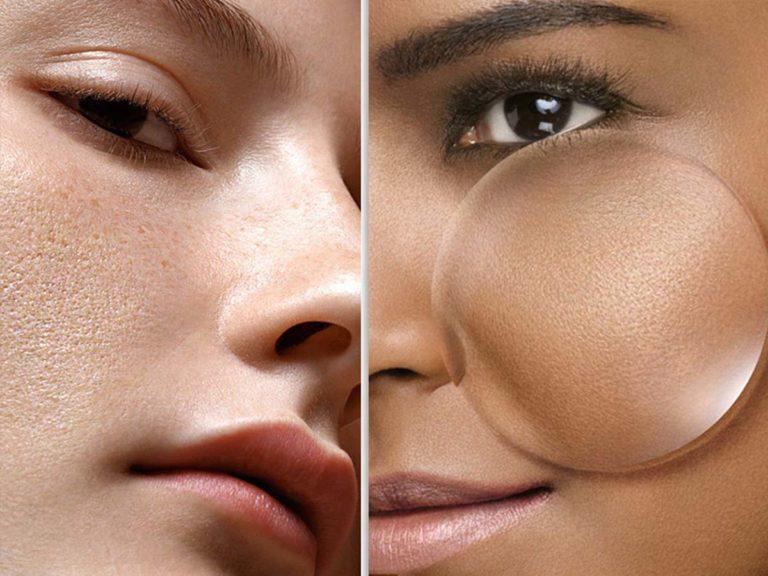 Έντονοι πόροι του δέρματος που οφείλονται και πως τους αντιμετωπίζουμε;