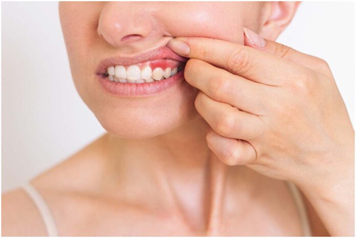 periodontitida-me-laser-ligoteros-ponos-pio-stoxeymenh-therapeia-mommyjammi1